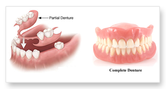 partial and complete dentures Image