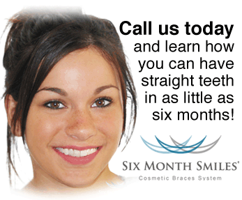 six-month-smiles-call-us-today Image