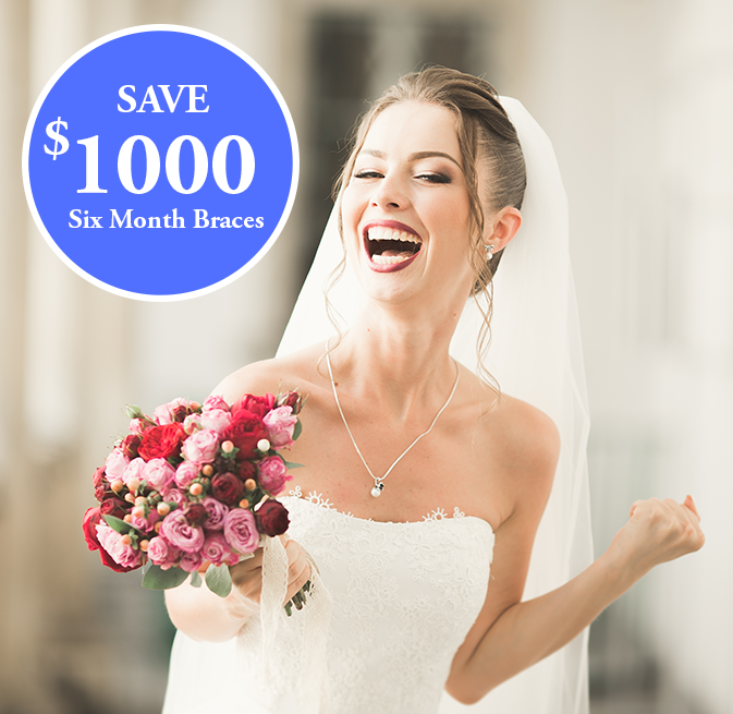 six-month-smiles special 1000 OFF Image